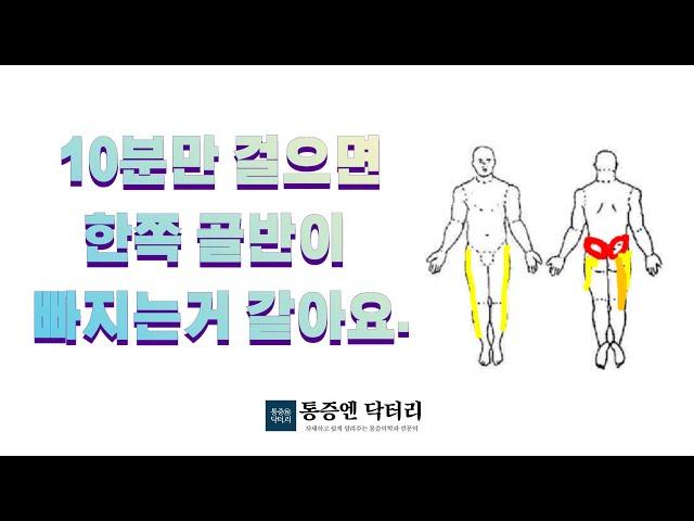 [사례]10분만 걸으면 한쪽 골반이 빠지는거 같아요. 누워있다가 뒤척이다가도 어느 자세만 되면 아파요. ㅜㅜ