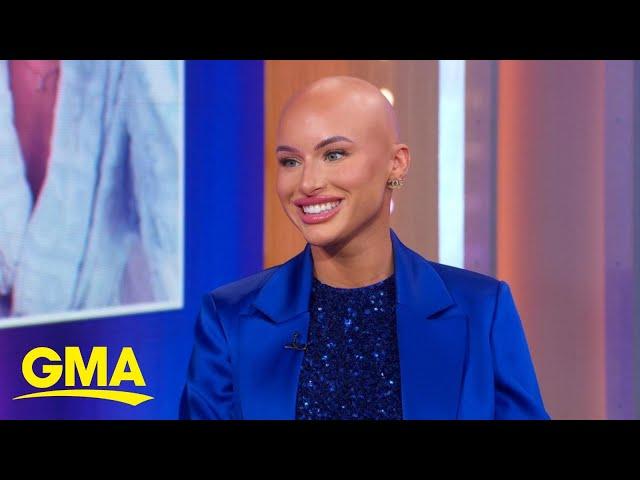TikTok star Chloe Bean talks alopecia journey