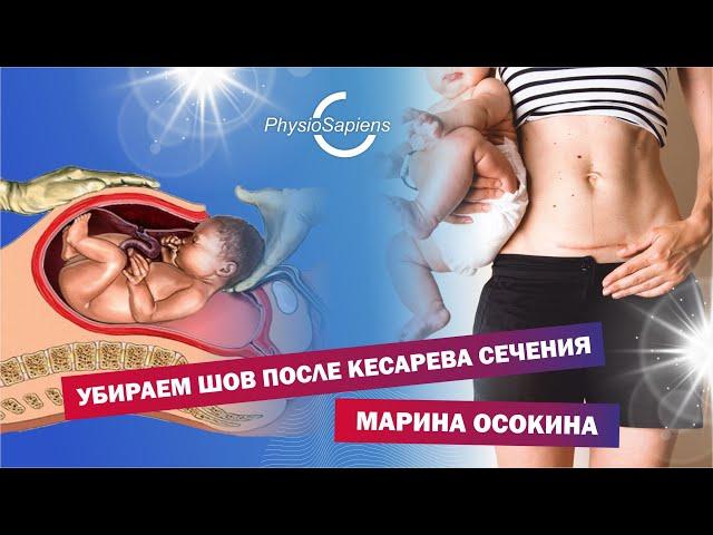 Убираем шов после кесарева сечения