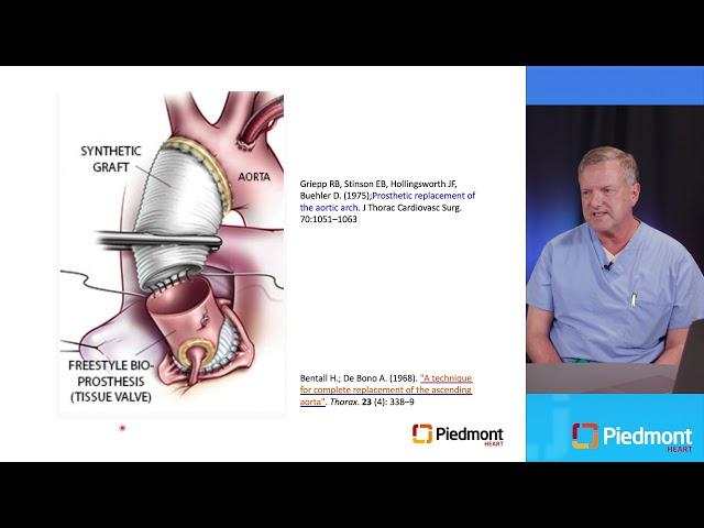 Complex Aorta Care: Cases and Discussion (CME)