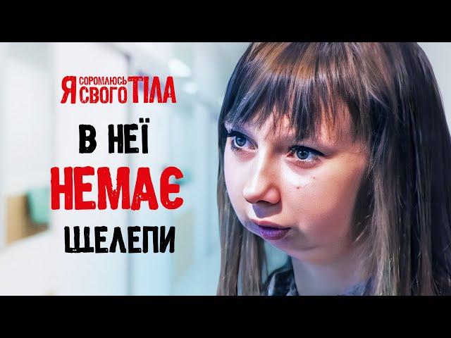 Втратила щелепу через залежність – Я соромлюсь свого тіла | ЛІКУВАННЯ | НАУКА | ЗДОРОВ’Я