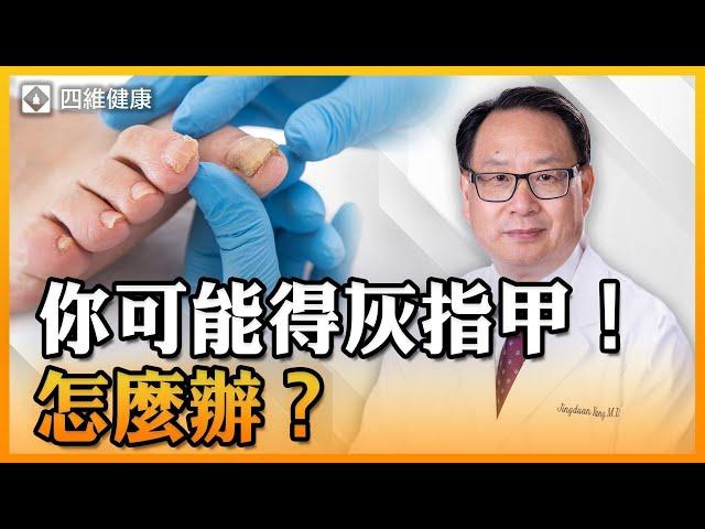 灰指甲在家就可以用的天然療法！怎樣預防和緩解症狀？