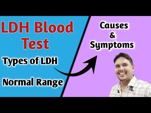 Lactate dehydrogenase test I symptoms of LDH