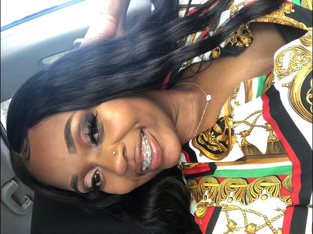 6 month braces update | MY GAP IS CLOSED