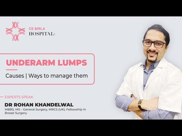 Underarm / Armpit lumps | Causes & Treatment | Dr. Rohan Khandelwal - Breast Cancer Surgeon