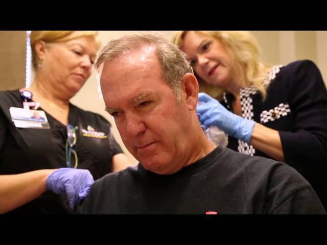 Hair Transplant Surgery: Richard’s Story