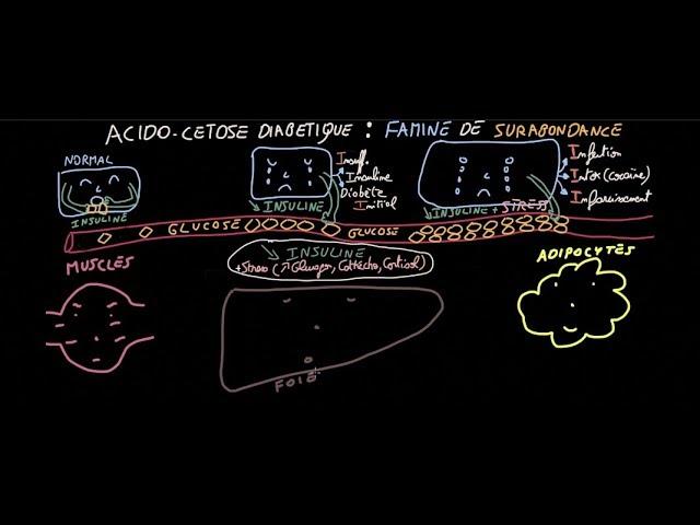 Acido-cétose diabétique - Famine de Surabondance - Partie 1 - Docteur Synapse