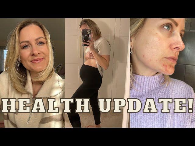 Health Update 2023! Fixing My Bloating & Adult Acne, Lara Joanna Jarvis | Gut Health & skin+me