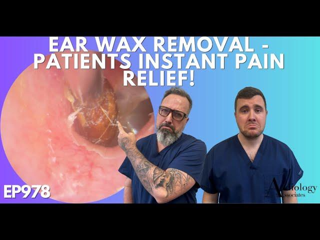 EAR WAX REMOVAL - PATIENTS INSTANT PAIN RELIEF - EP978