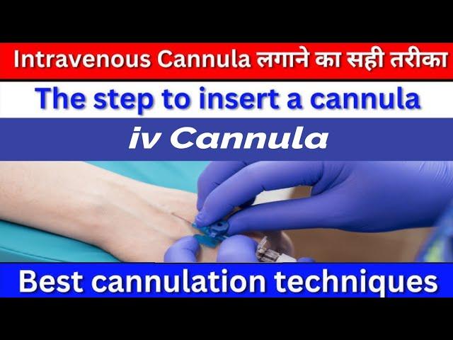 How to Insert an IV (Cannulation Technique)