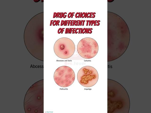 Drug of choice for infection // Antibiotics // pharmacology #medical #antibiotics #health #drugs