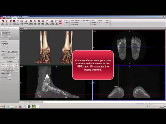 CubeVue - Insta-X X-Ray Views
