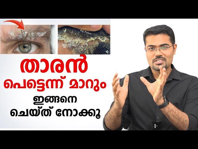 താരൻ പെട്ടെന്ന് മാറും ഇങ്ങനെ ചെയ്താൽ | Dandruff Treatment at Home |Dr Manoj Johnson /Baiju's Vlogs