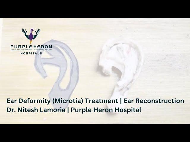 Ear Deformity (Microtia) Treatment | Ear Reconstruction | Dr. Nitesh Lamoria | Purple Heron Hospital