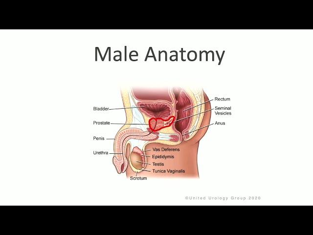 Robot Assisted Radical Prostatectomy