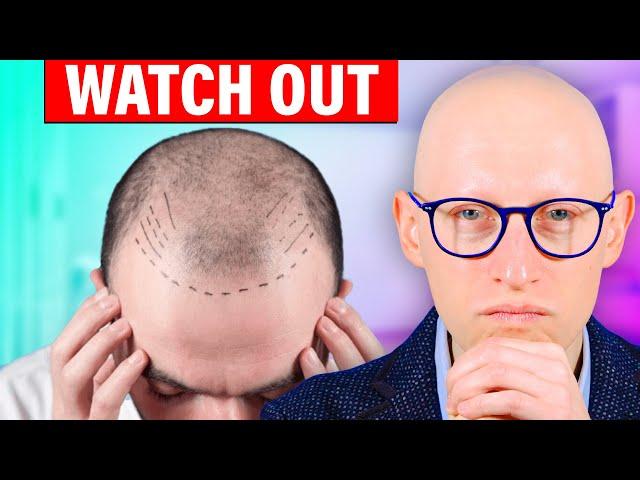 Biggest Hair Transplant SCAM? DHI vs FUE