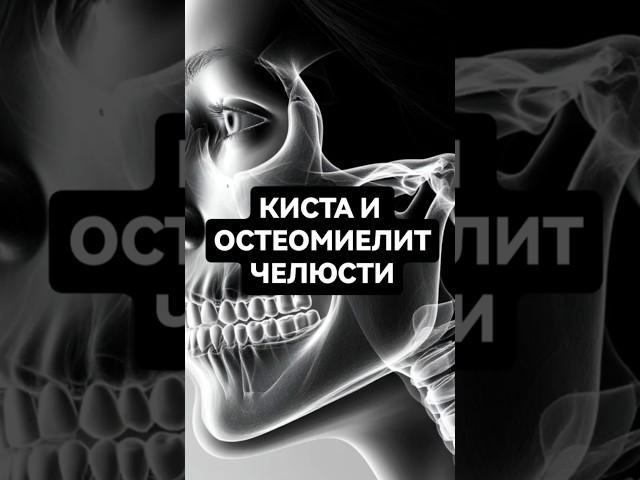 Киста и остеомиелит челюсти