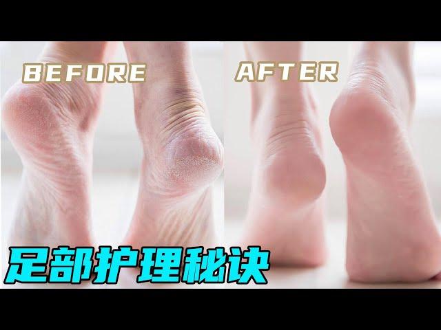 From cracked and cracked skin to white,tender and smooth,Kaka’s foot care secrets have been revealed