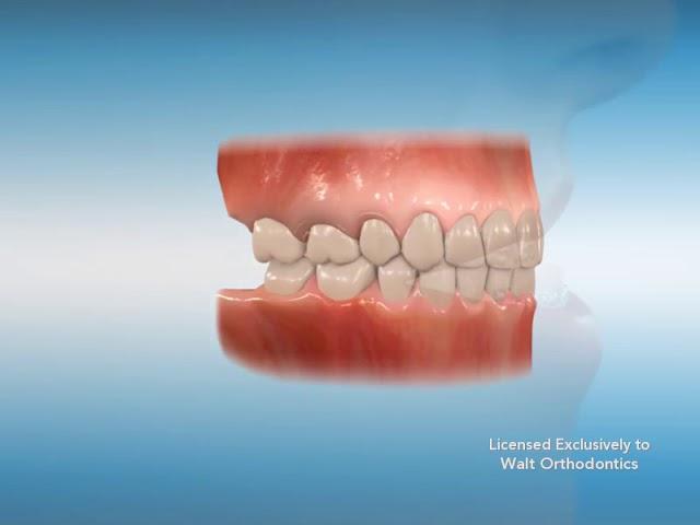 Extractions 5x4