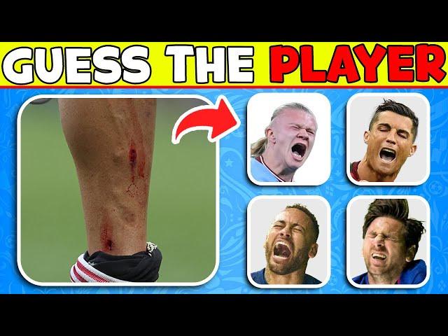 Guess Football Player by his INJURY and RED CARD ️‍🩹 Football Quiz about Ronaldo, Messi, Neymar