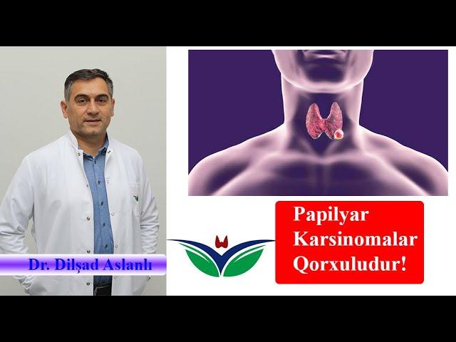 MÜTLƏQ İZLƏYİN!!!  Papilyar karsinomalar bu səbəbdən qorxuludur!  Dr.Sadiq Bəbirov