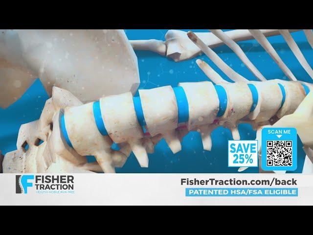 Quick And Easy Lower Back Pain Relief At Home With Fisher Traction | FisherTraction.com