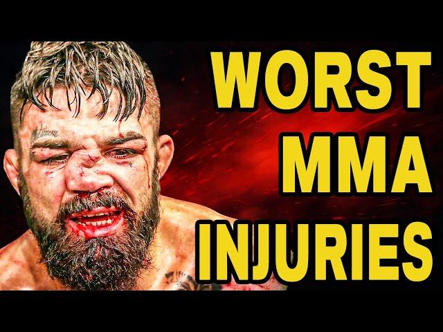12 MMA Injuries So Bad They're Still Talked About