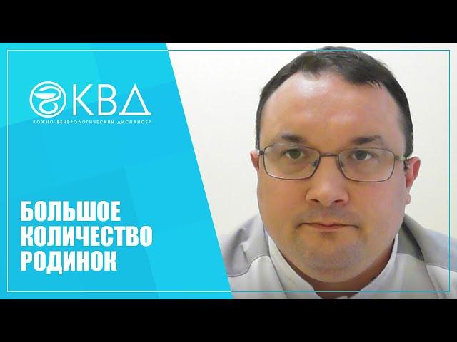 1156  Большое количество родинок