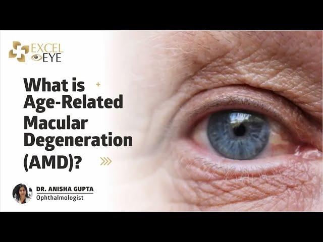 Age-Related Macular Degeneration (AMD): Types,Causes, Symptoms,Treatment | Dr Anisha Gupta, at Delhi