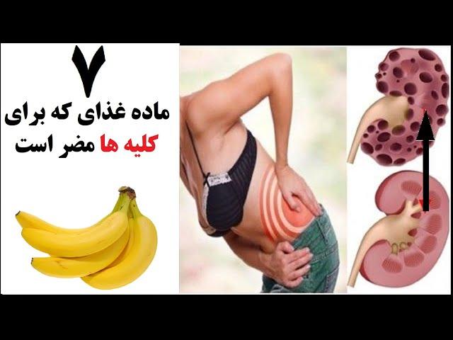 ۷ ماده غذای که برای کلیه ها مضر است