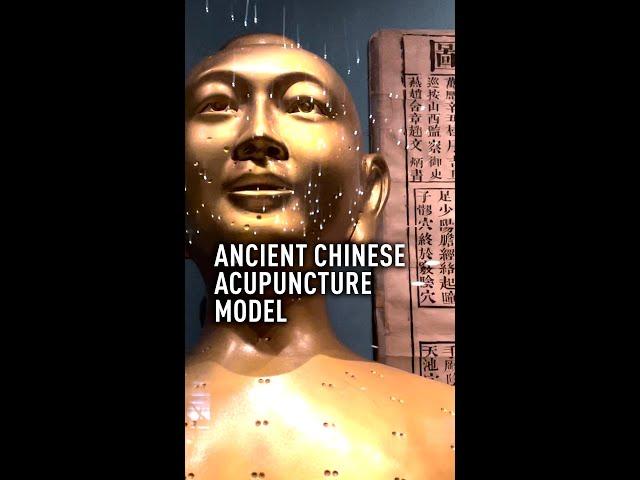 Ancient Chinese acupuncture model