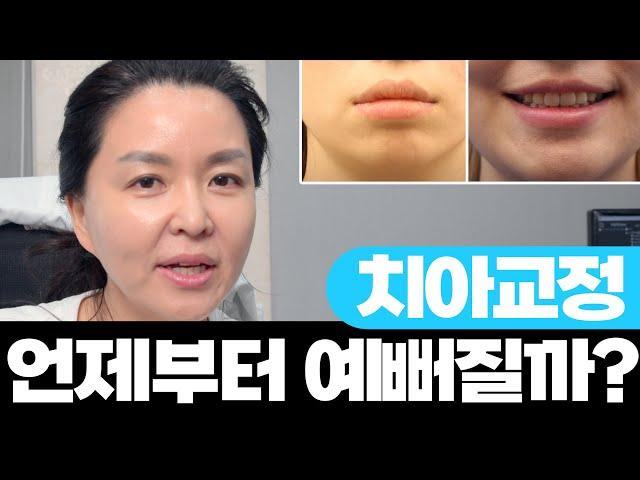 그래서 교정 시작하고 언제부터 예뻐지냐고요!!