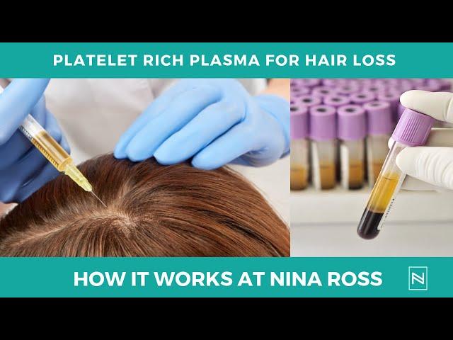 PRP For Hair Loss | Why We Get Better Results | PRP Treatment | @NinaRossATL