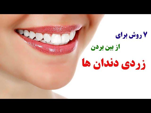 از بین بردن زردی دندان ها با 7 روش خانگی