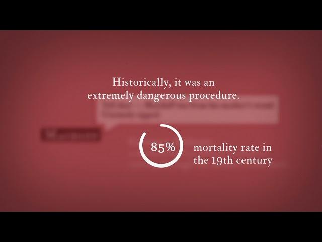 myShakespeare | Macbeth 5.7 Historical Reference: Caesarian Delivery