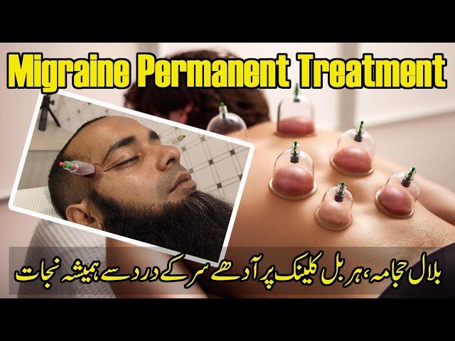 Wet Cupping Therapy in Karachi | Hijama for Migraine | Bilal Hijama Clinic | 100% Results in Pain