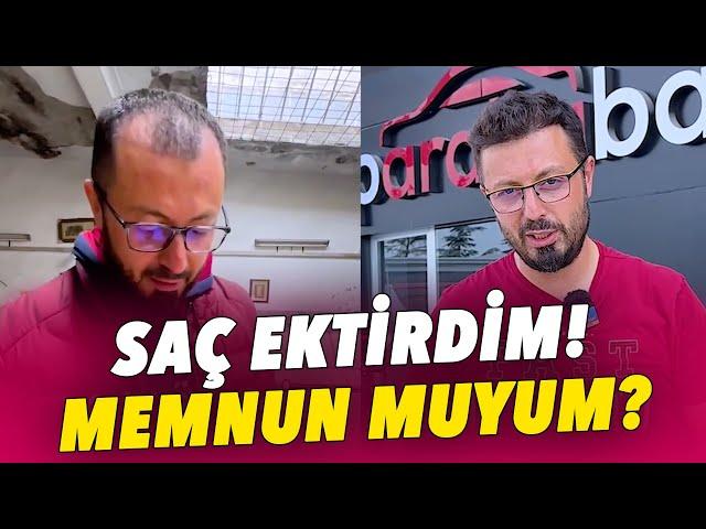 SAÇ EKTİRDİM 10 YAŞ FARK ETTİ!