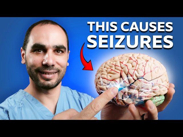 Neurologist Explains How Epilepsy ACTUALLY Works