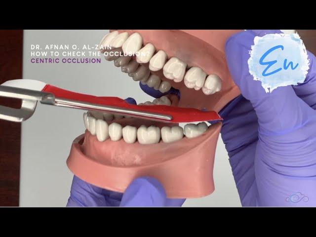 How to check the occlusion? - En