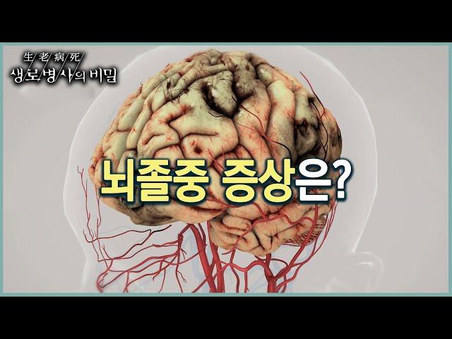 뇌졸중은 어떤 병? (KBS 20220914 방송)