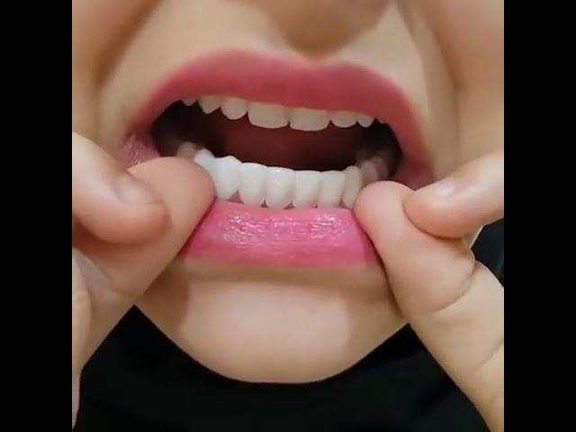 Perfect Smile Teeth SNAP ON VENEERS - Snap on teeth | EllePeri - Instant Smile Snap-On Smile Veneers