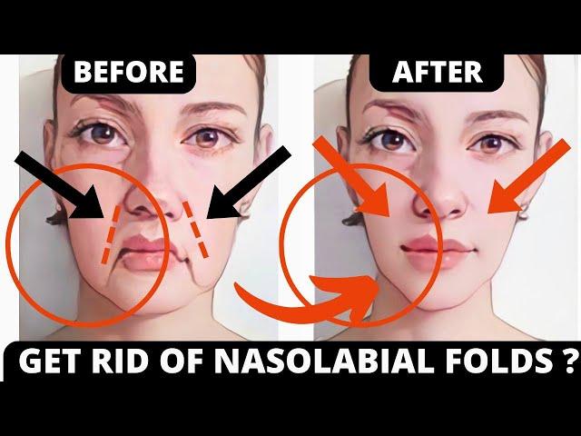 HOW TO REDUCE NASOLABIAL FOLDS ? FACE LIFTING EXERCISES FOR SMILE LINES, LAUGH LINES