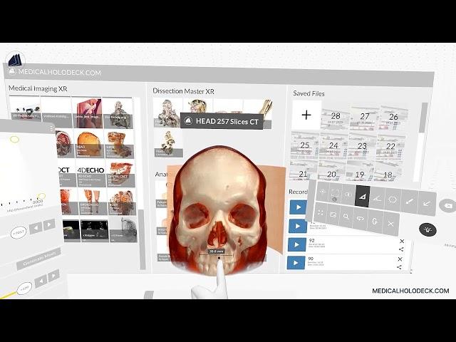 Measuring Distances in Virtual Reality: Precise Spatial Measurements in Medicalholodeck