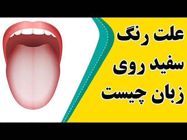 علت سفیدی روی زبان در طب سنتی و راههای درمانی آن