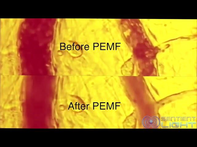 Blood Movements Images Before and After PEMF Treatments