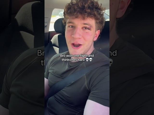 Connor Sinann Crazy FACE SCAR FROM FIGHT?