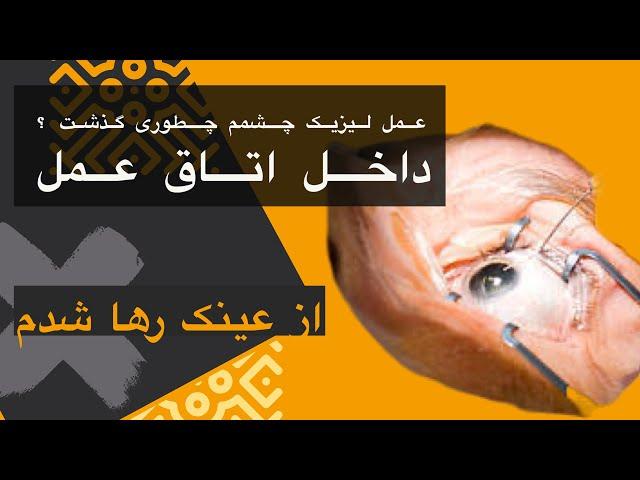 عمل لیزیک چشم ! برای اینکه از عینک و چم ضعیف رها شوم عمل لیزیک انجام دادم