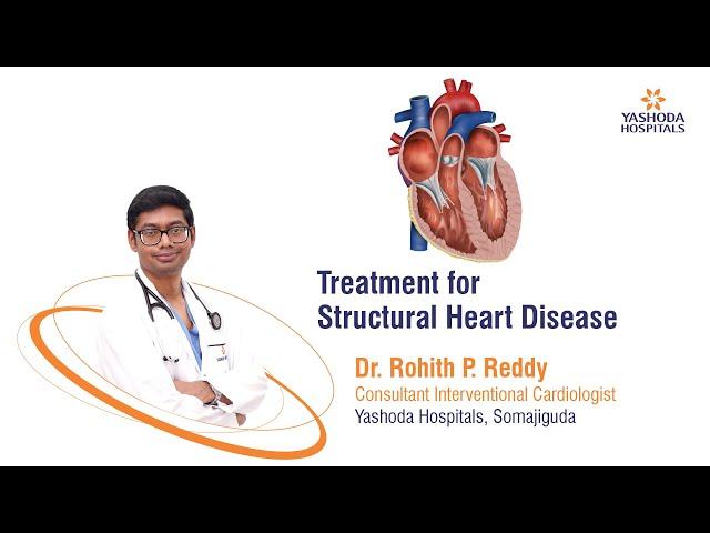 Treatment of Structural Heart Disease | Yashoda Hospitals Hyderabad