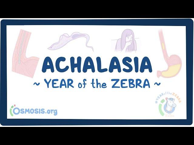 Achalasia (Year of the Zebra)