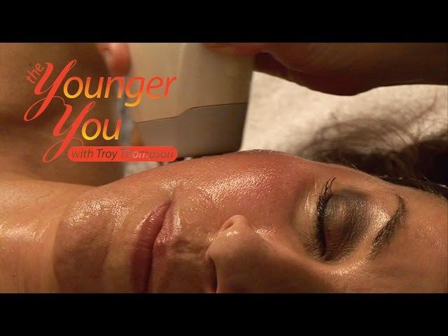 The Younger You With Troy Thompson - Episode 09 Skin Resurfacing